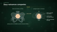 Le passage de la tête du bébé dans le bassin humain